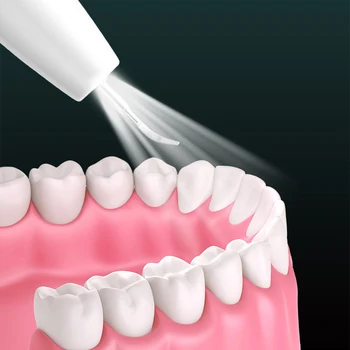 Ультразвуковой Зубной Скейлер, Электрический Зубной камень Для Удаления Зубного камня, Средство для удаления пятен налета, Средство для отбеливания зубов