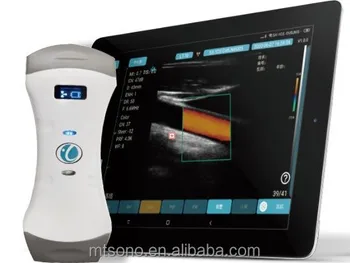 Портативный ультразвуковой аппарат для беременных От Реального производителя Медицинские ультразвуковые инструменты Ультразвуковой сканер Изображение 2